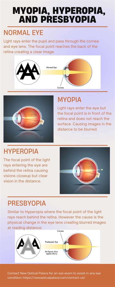 presbyopia vs hypermetropia.